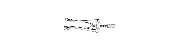 Alm Retractor