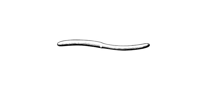 Hegar Uterine Dilator