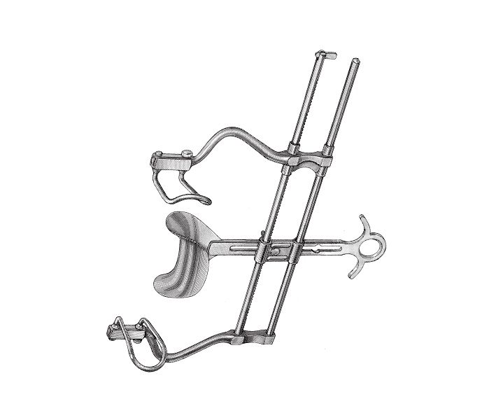 Balfour Abdominal Retractor with Ratchet Bar Positioning Mechanism