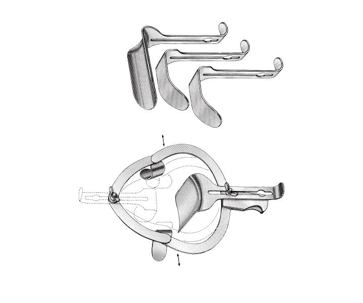 O Sullivan-O Connor Abdominal Retractor