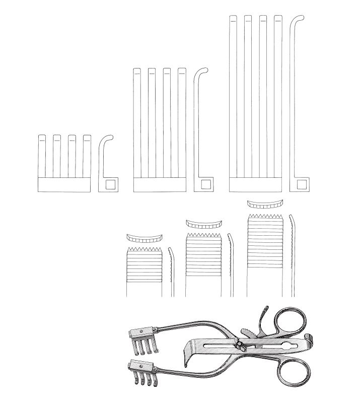 Henly Retractor